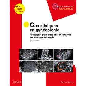Cas cliniques en imagerie : gynécologie