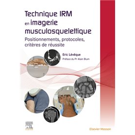 Technique IRM en imagerie musculosquelettique