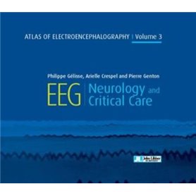 Atlas of electroencephalography - Volume 3