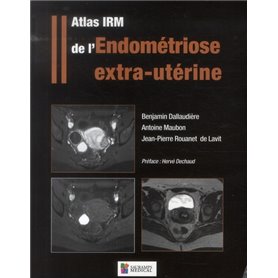 ATLAS IRM DE L'ENDOMETRIOSE EXTRA-UTERINE