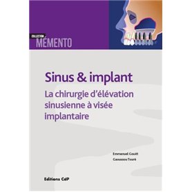 Sinus et implants