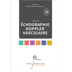 Echographie doppler vasculaire