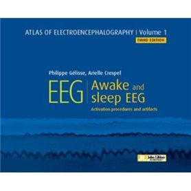 Atlas of electroencephalography - Volume 1