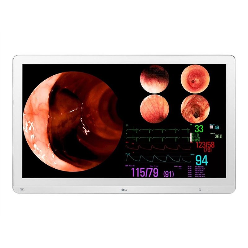 LG 32HL512D-B/31.5